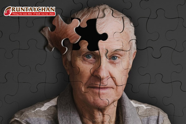 Mất trí nhớ do bệnh Parkinson
